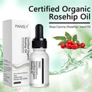 Rosehip Oil Moisturizing Essential Oil Rose Hip Skin Scars Acne Care Serum G1A2