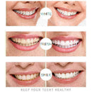 Baking Soda White Toothpaste Teeth Whitening Cleaning Tooth Care Oral Hygie G7U2