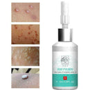 Ear Cleaner Antibacterial Solution For Pet Dog Cat Magic B6V3 100ml Z0Y6 Q4S7