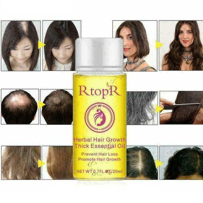 Fast Powerful Hair Growth Essential Oil Liquid Treatment Preventing Hairs L A3X3