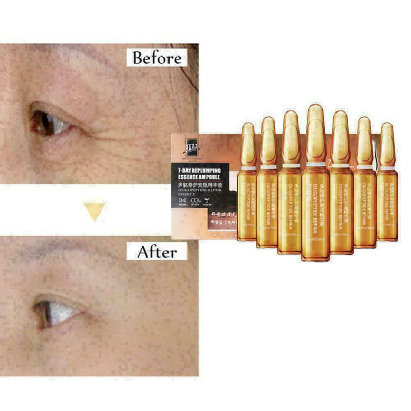 7X Hyaluronic Acid Ampoules Brighten Essence Dark Spots BES Remover Freckle L8K3