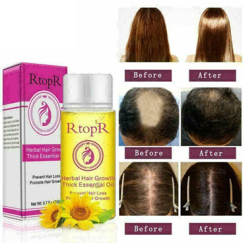 Fast Powerful Hair Growth Essential Oil Liquid Treatment Preventing Hairs L A3X3