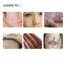 Beauty mole removal sweep Dark spot pen plasma Multifunction pen With Light LCD