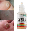 Chinese Medicine Treatment Foot Corn Removal Plantar Foot Car R8M9 warts Ve R8E9