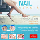 Nail Protection Liquid Repair Remove Liquid Bright Nails Gray Nail Pen
