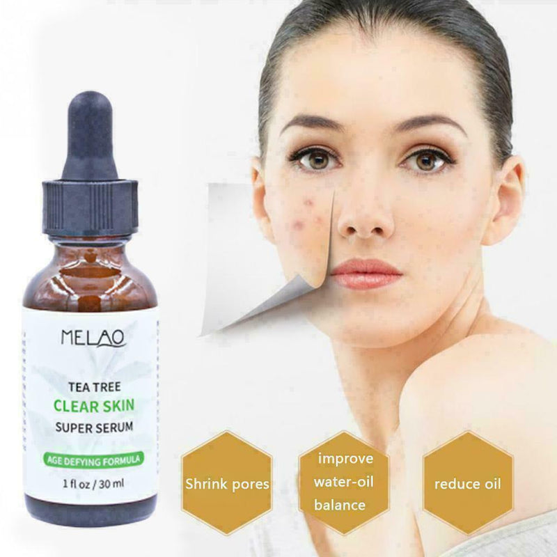 Pure Natural Tree Essential Oil Acne Treatment Face Care Z Skin H4F4 H2F6