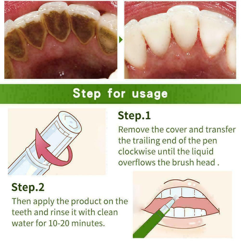 Teeth bright white pen teeth whitening remove plaque stains smoke stains B4 L7V8