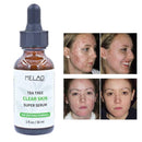 Pure Natural Tree Essential Oil Acne Treatment Face Z Skin Care Z1R9