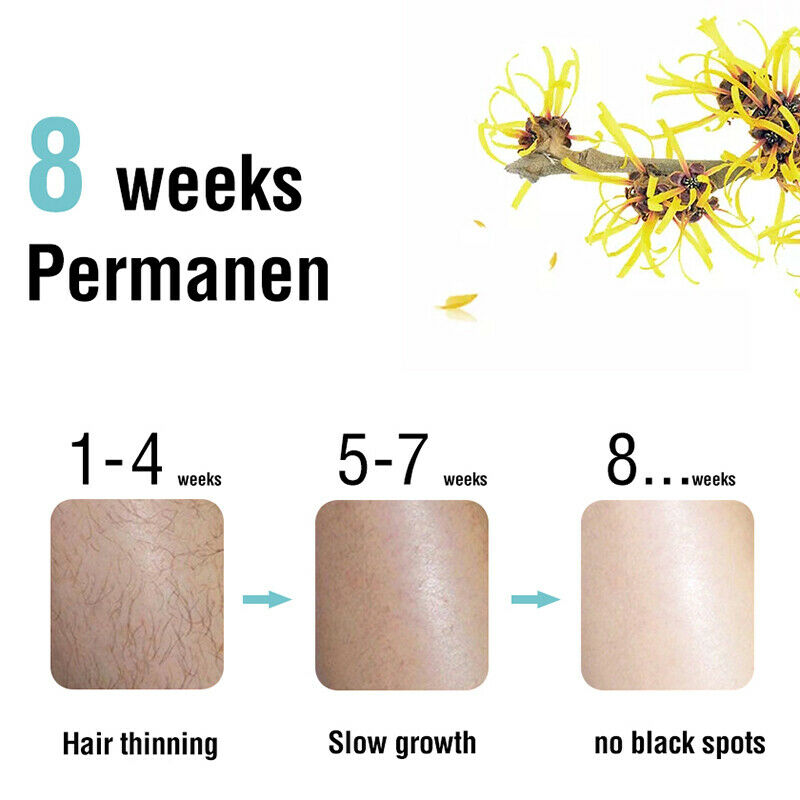 Lanthome Effective Permanent Hair Growth Inhibitor After Hair Removal Repai O1S2