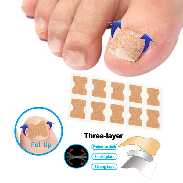 60Pcs Toenail Corrector Stickers Toe Nail Fixer Toe Nail Care Correction