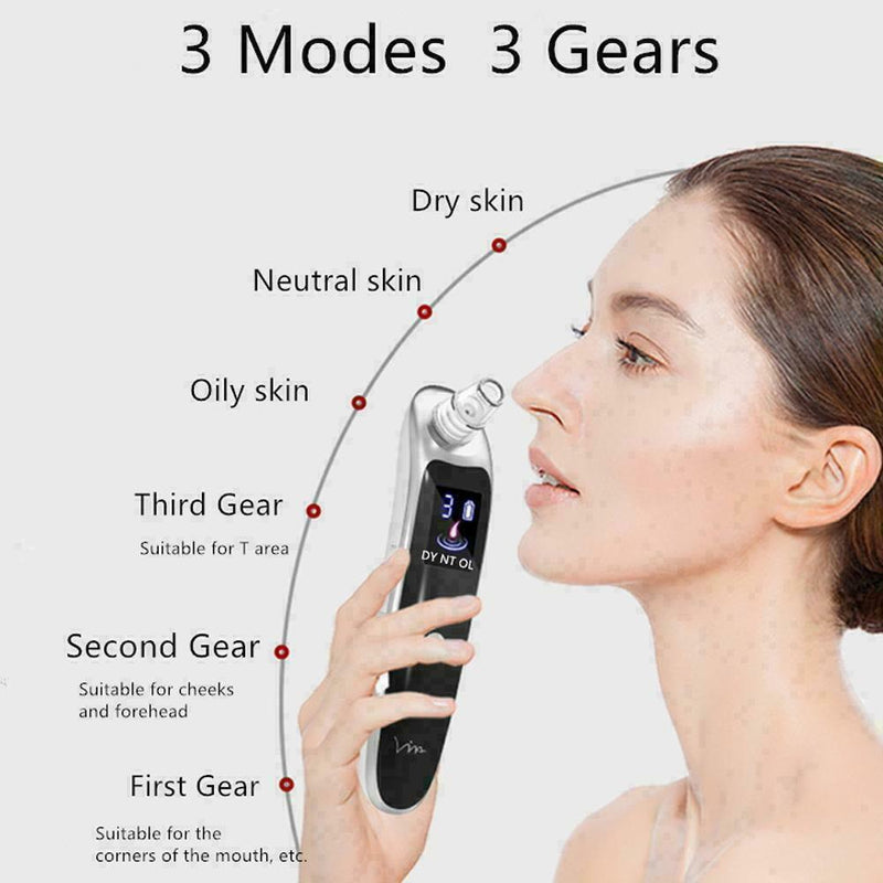 Electric Acne Blackhead Vacuum Cleaner Skin Care Tool Nose Clean Face Pores I0B8