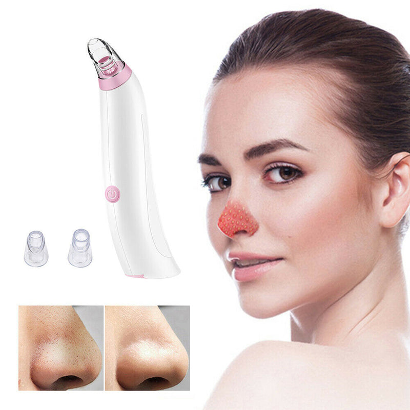 Electric Facial Blackhead Remover Vacuum Suction Skin Nose Pore Cleaner