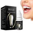 Teeth Whitening Cleaning Teeth Remove Stains/Coffee Stains W6V5 D2X0 Favor H5M2
