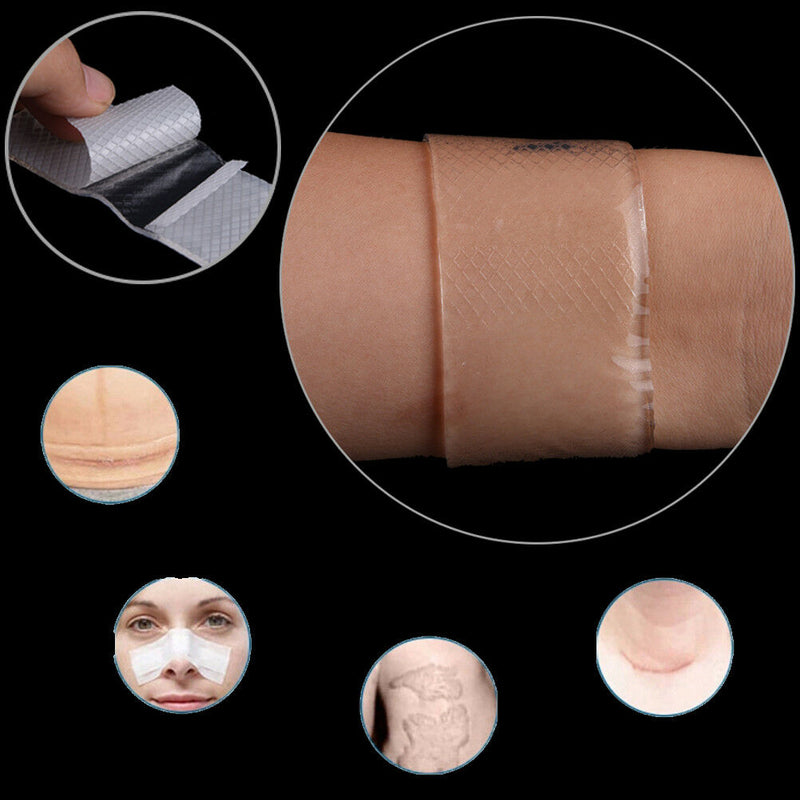 Silicone Gel Sheet Scar Treatment Repair Keloid Cesarean Away Wound Removal`o Pg
