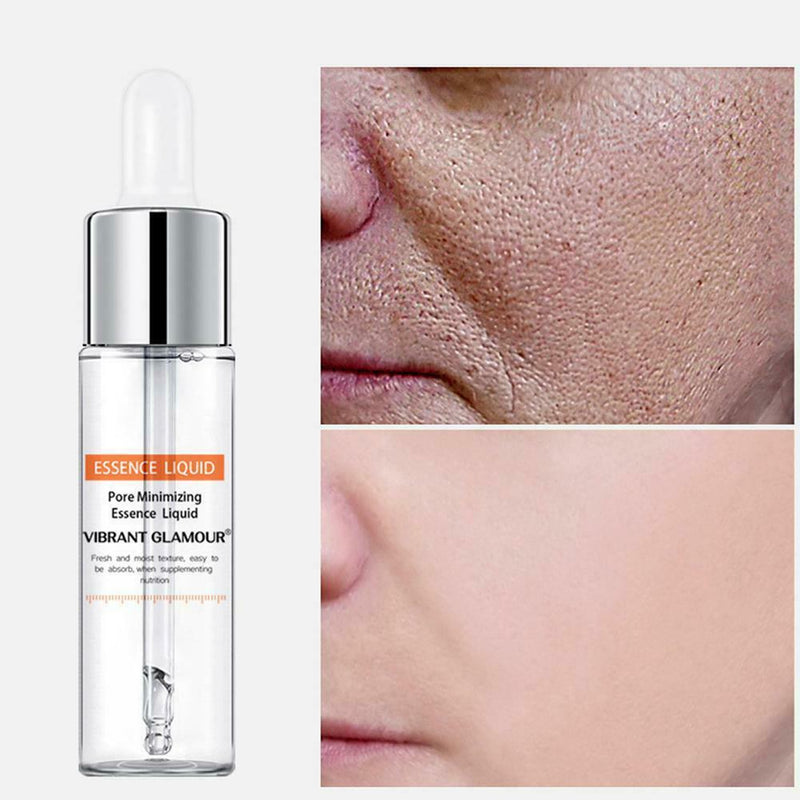 Vibrant Glamour 15ml Salicylic Acid Liquid Shrink Pore Essence Blackhead Ac A2Y7