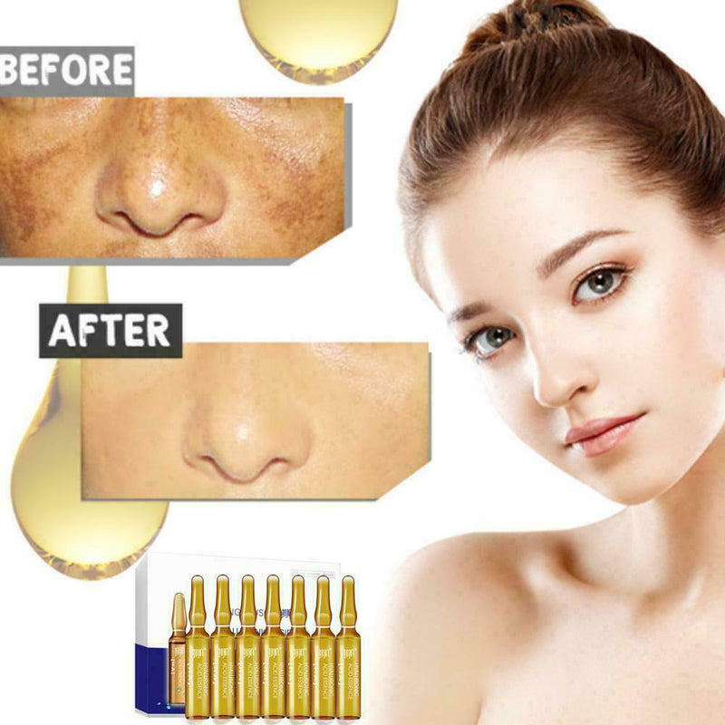 Whitening Spotless Ampoule Serum (Set of 7) W1O7