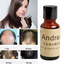Hair Growth Liquid Oil Natural Organic Regrowth Treatment Hot