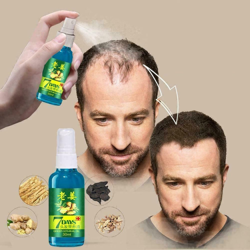 30ML Fast Hair Growth Essence Ginger Liquid Hair Loss Hair Care Treatment I2W8
