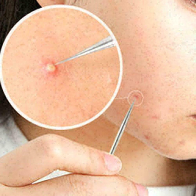 1Pc Acne Blackhead Remover Cleaner Blemish Needle Pimple Extractor HOT A5H7 P7Q9