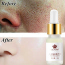 Pore Shrinking Essence Tightening Oil-control Moisturizing Blackhead Remo HY ME