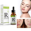 Retinol Foil Essence Oil Face Lift Whitening Moisturizing Anti-Age Serum Fa R4R2