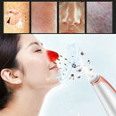 Fully Electric Electric Blackhead Remover Vacuum Pore Cleaner Facial Exfoli