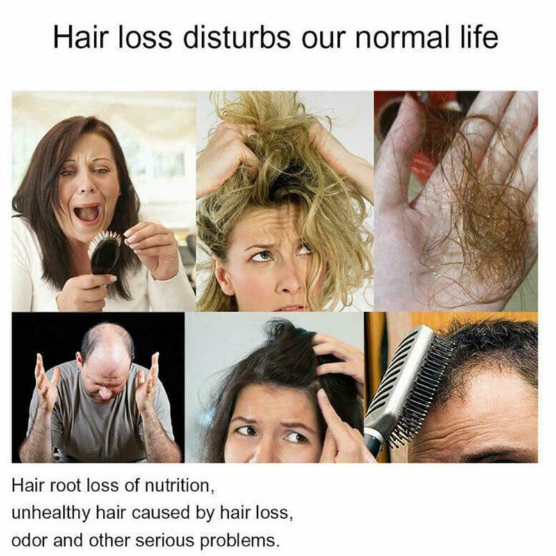 30ml Rapid Hair Growth Boosting Serum Regrowth Essence Treatment Shampoo