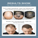 20ml Tea Tree Essential Oil For Hair Growth Lice Face Prevent