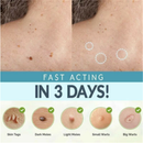 72PCS DERMOPATCHY ACNE SKIN TAGS PIMPLE REMOVER PATCH REMOVAL FACIAL CARE SPOTS