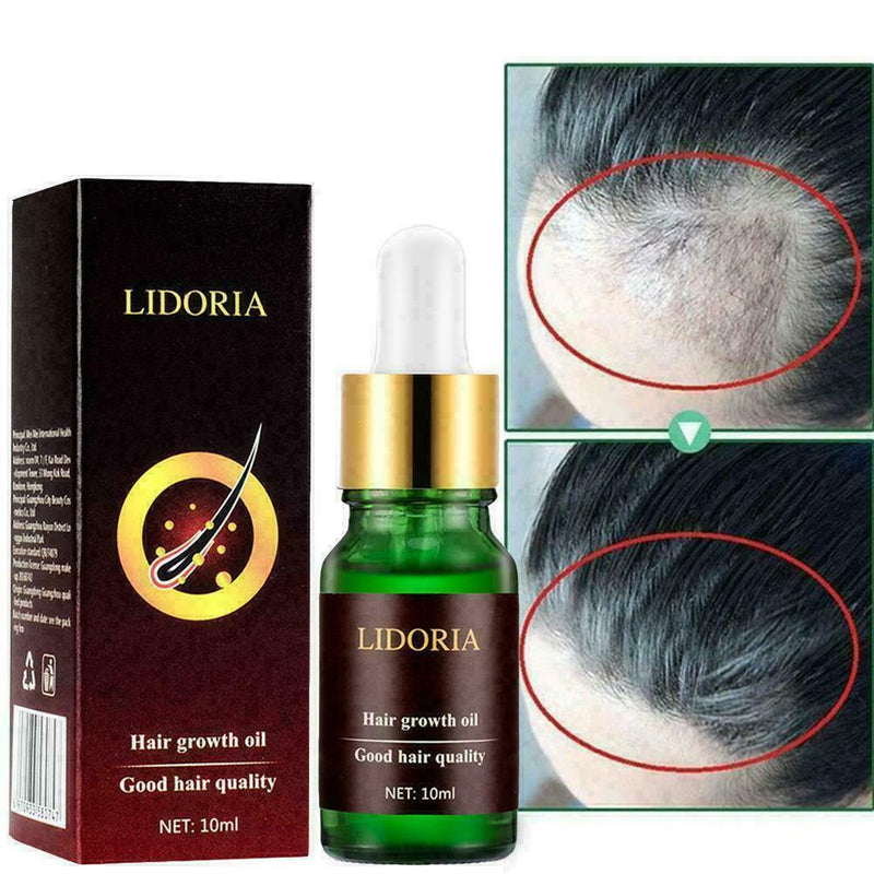 2019 Ginger Germinal Hair Growth Serum Hairdressing Oil Loss Treatement A9H D0S3
