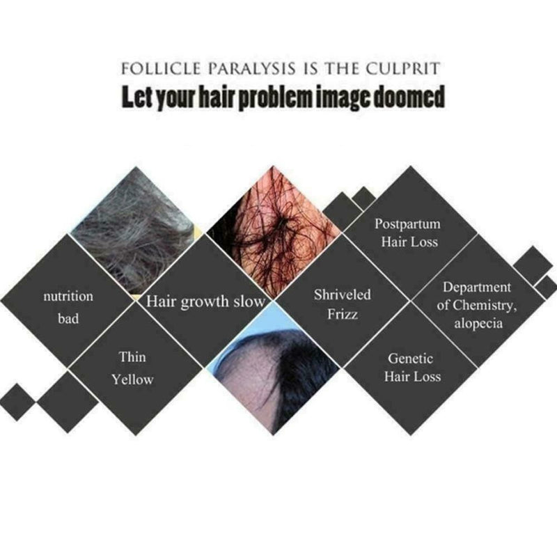 30ML Fast Hair Growth Ginger Liquid Hair Loss Treatment Care Hair E6R2