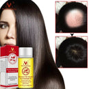 MeiYanQiong Morocco Nuts Hair Fast Powerful Growth Essence 3PCS Preventing