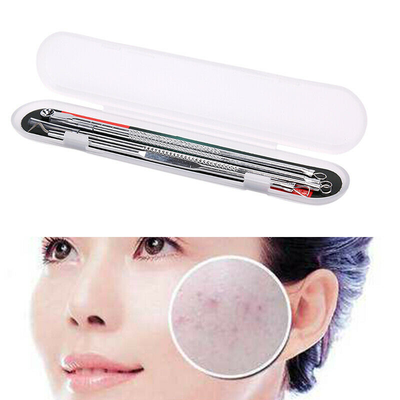 Tools Kit Acne Extractor Remover Blackhead Pimple Needles Blemish Treatments Gw