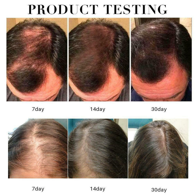 30ML Natural Hair Growth Spray Fast Thick For Men Hair Women Oil Treament Q5Y7