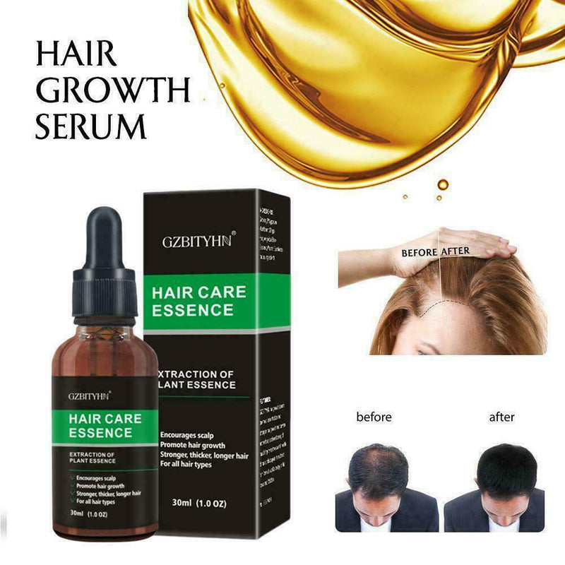 Hair Revitalizing Serum Ginger Fast Growth Essential Anti Preventing Oil L4T4