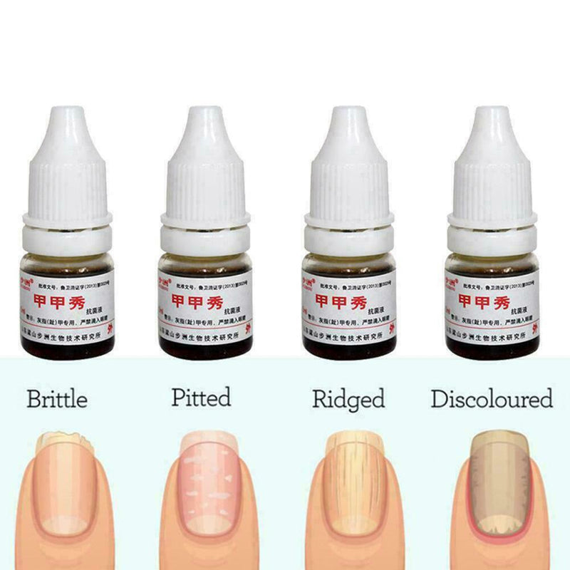 Footcare Oil 15ml Gehwol Nail Softner Fluid Ingrown Nails Callus Toe Z2L1