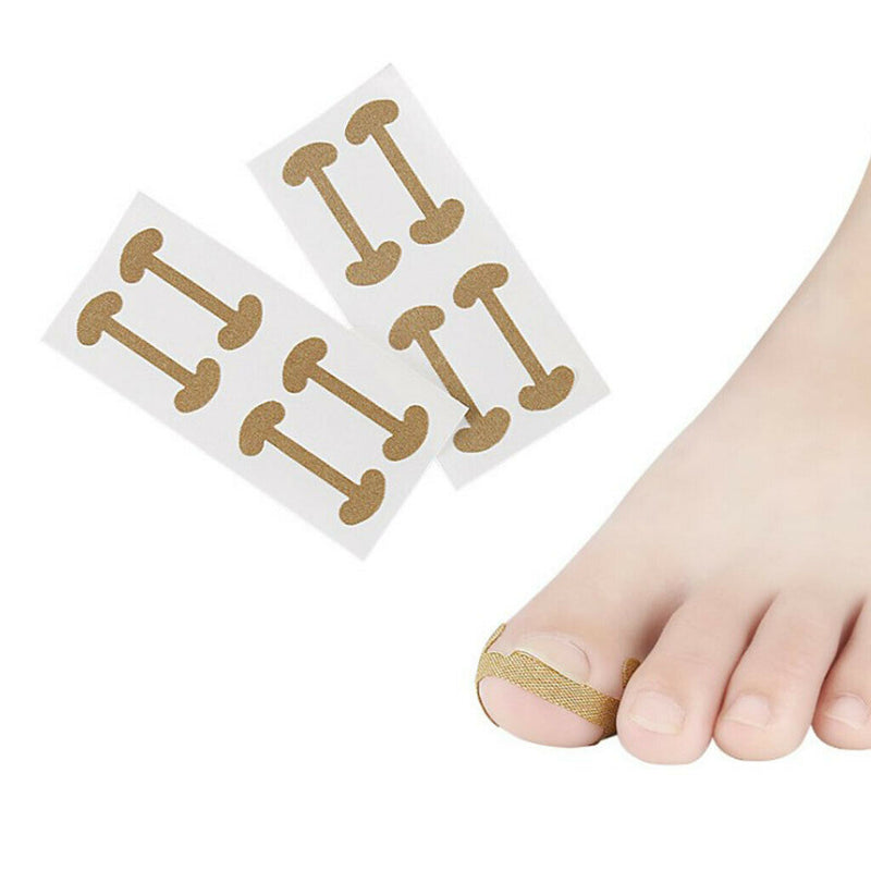 20 Pcs Ingrown Nail Correction Stickers Toenail  Brace Foot Care