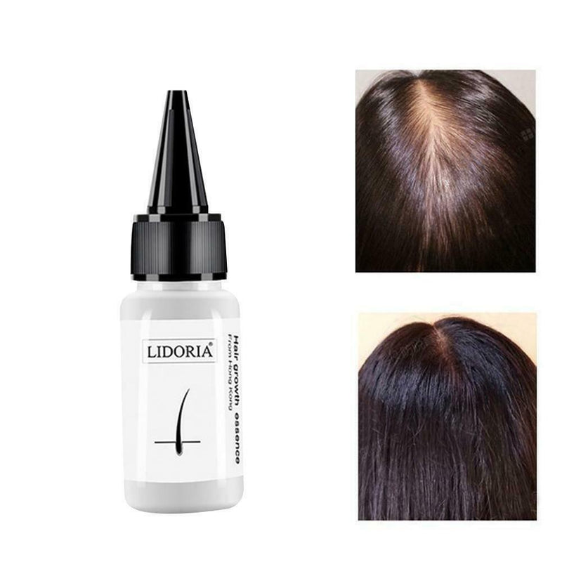 20ml Polygonum Multiflorum Hair Conditioner Fast Hair Growth Essence Oils