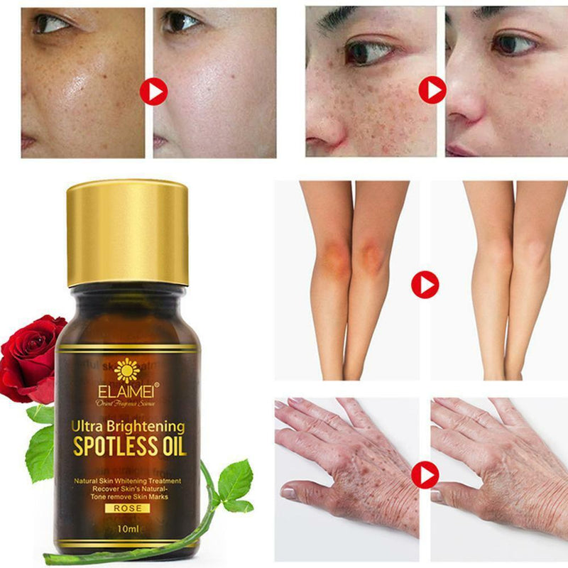 Rose Brightening Spotless Oil Skin Care Natural Pure Remove Dark Spots 10ML