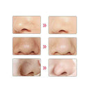 1PC Electric Blackhead Instrument Acne Cleansing Face Pore Nose Cleaner Ar ZBI