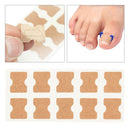 Set of 30 Toenail Corrector Stickers Toe Nail Elastic Corrector Correction