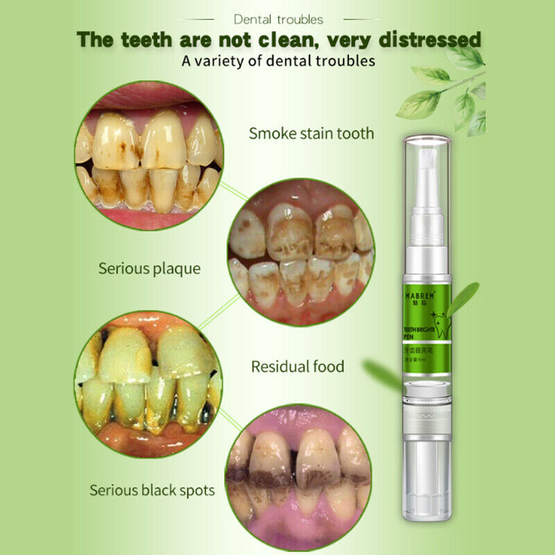 Meiyanqiong Dental Brightening Pen Oral Hygiene Essence Teeth Whitening Ser V6R4
