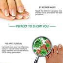 4Pcs Nail Liquid Pen Cuticle Remover Onychomycosis Nail Fungus Care Liquid I5N3