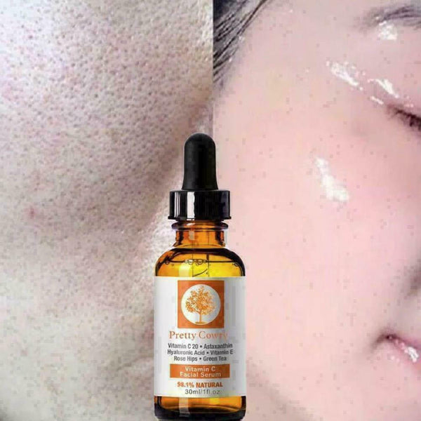 30ml Spots Remove Vitamin C Essence Face Serum Green Tea Oil Hyaluronic Aci M8T9