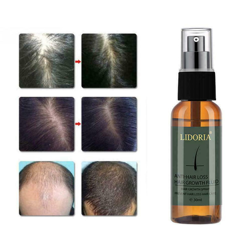 30ML Hair Growth Spray Fast Grow Hair Treatment Preventing Hair Hair Loss C J9O9