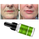 MeiYanQiong Nicotinamide Collagen Repair Solution Serum Repair Skin Anti-Ag G5P9