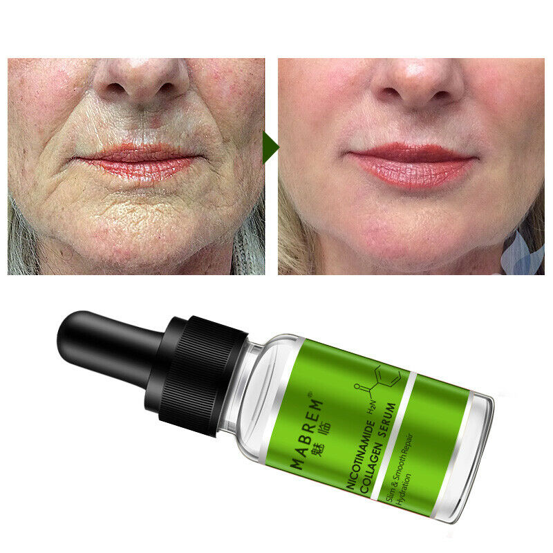 MeiYanQiong Nicotinamide Collagen Repair Solution Serum Repair Skin Anti-Ag G5P9