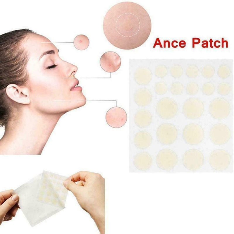 24x Skin Tag & Acne Patch - New Hydrocolloid Acne And Skin Tag Remover Patc C0U4