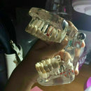 Teeth Restoration Implant Removable Disease Tooth & Teaching Dental Bridge A2X0