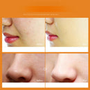 Baimiss Snail Repair Serum Face Care Acne Treatment Blackhead Remover Repai